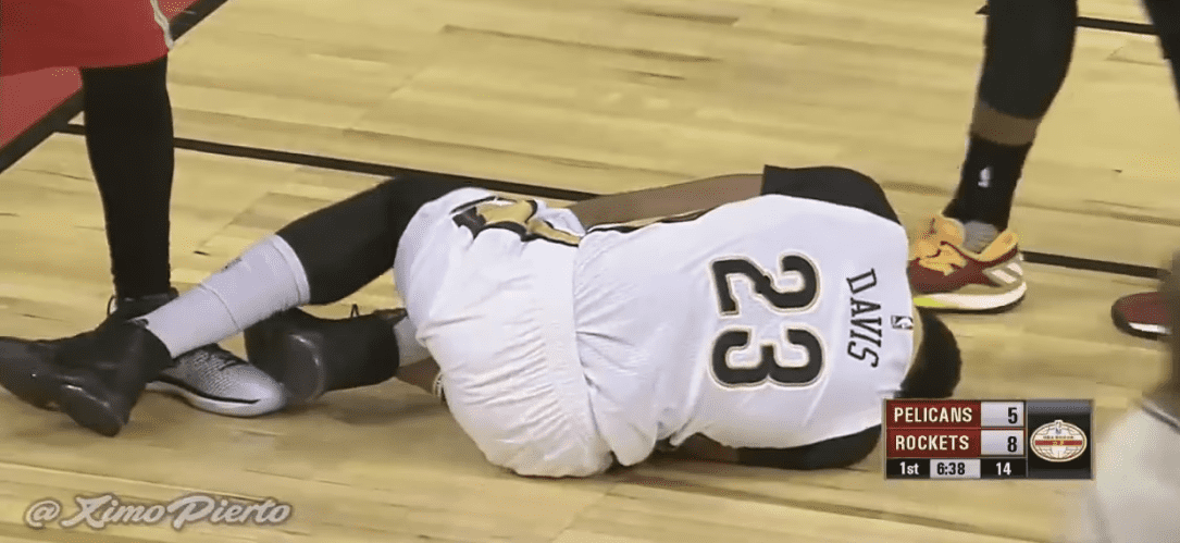 Anthony Davis
